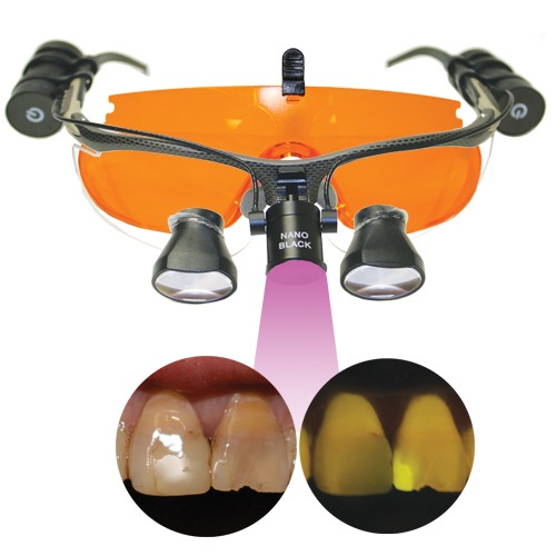 Nano Black Loupe Light AAO Special 91