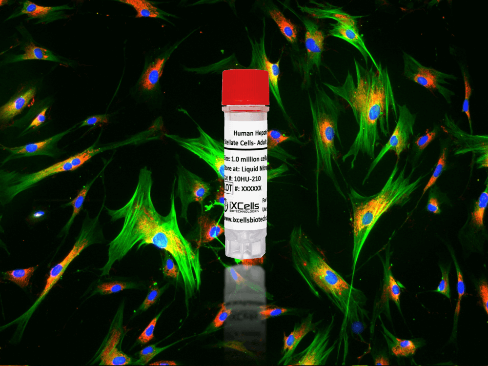 10HU-210: Human Hepatic Stellate Cells- Adult (HHSC) 361