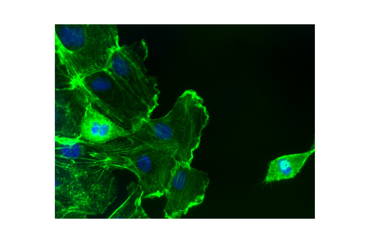 Fluorescent phalloidins for detecting actin fibers 58