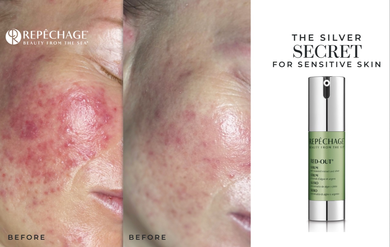 The Silver Secret: Key Ingredient In The Repêchage® Red-Out® Collection 49