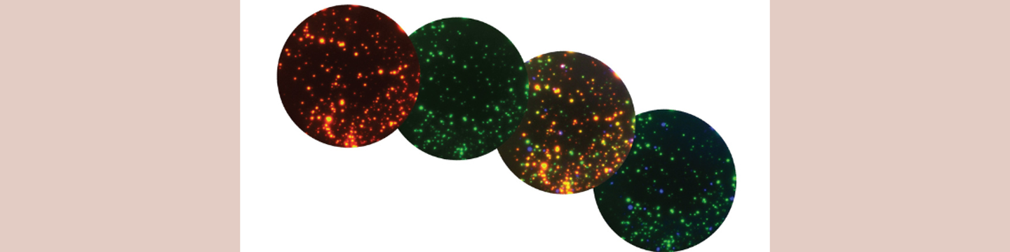 AID Autoimmun Diagnostika GmbH 111