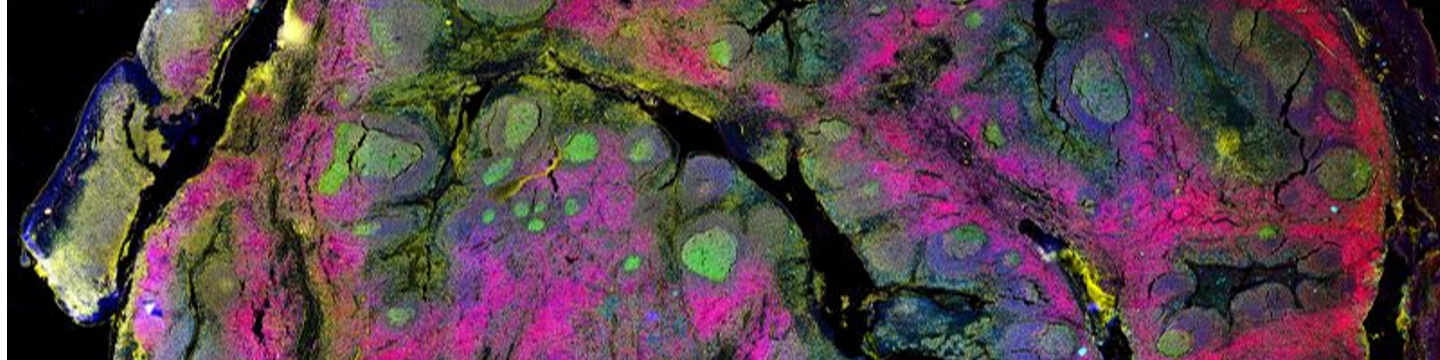 Bruker Spatial Biology 61