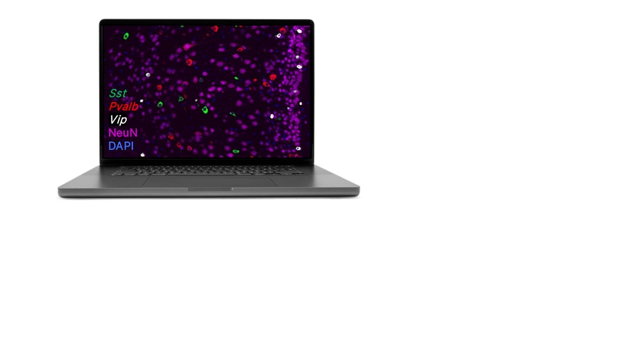 RNAscope Multiplex Assay with PretreatPro   Same-Section RNA and Protein Detection Protease-Free 59