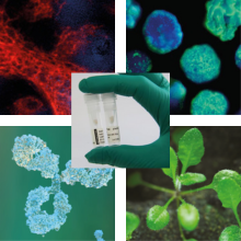 Agrisera Antibodies 75