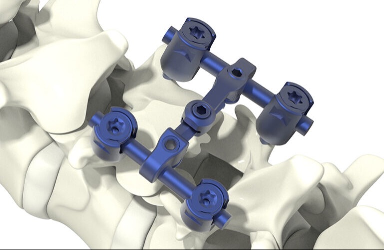 Orthobond wins FDA de novo approval for antibacterial technology that could have vast device applications 206