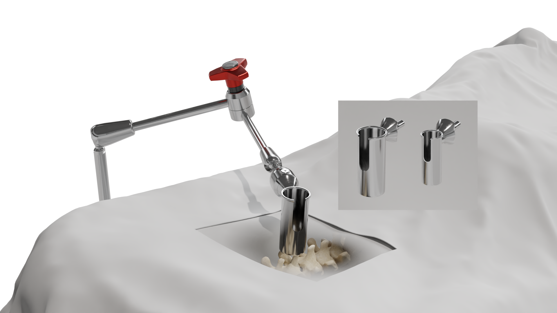 Novid Surgical, FISSO Articulated Arms for Spinal Surgery 57