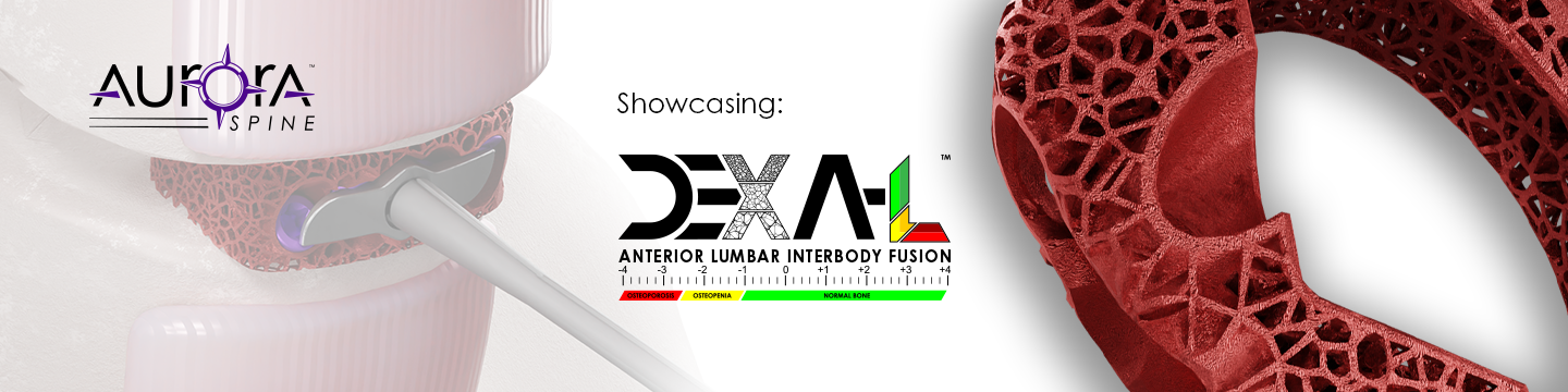 Aurora Spine 63