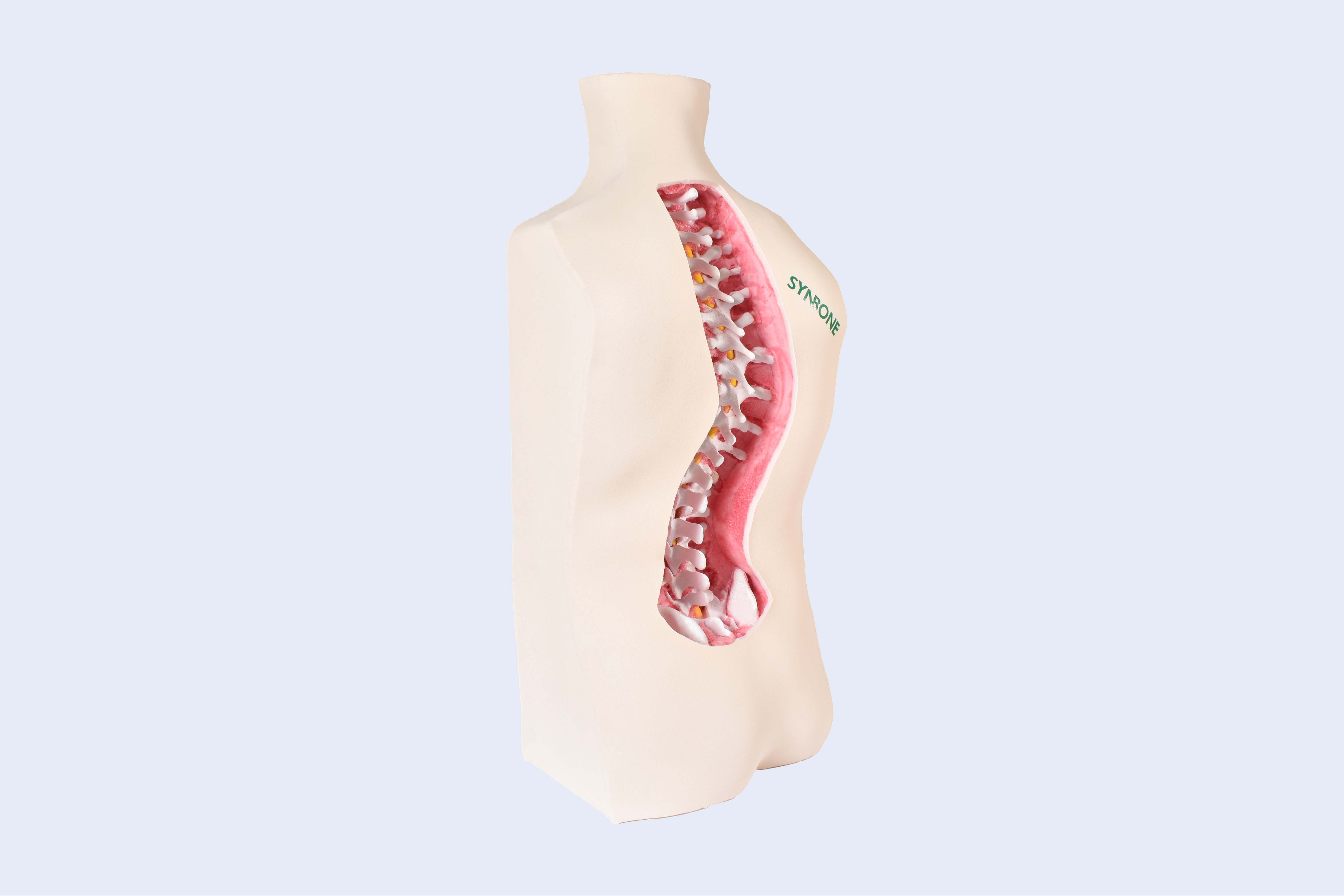 Spine Torso C1-L5 w/ Pelvis, Lenke 3 Scoliosis Bone Model 267