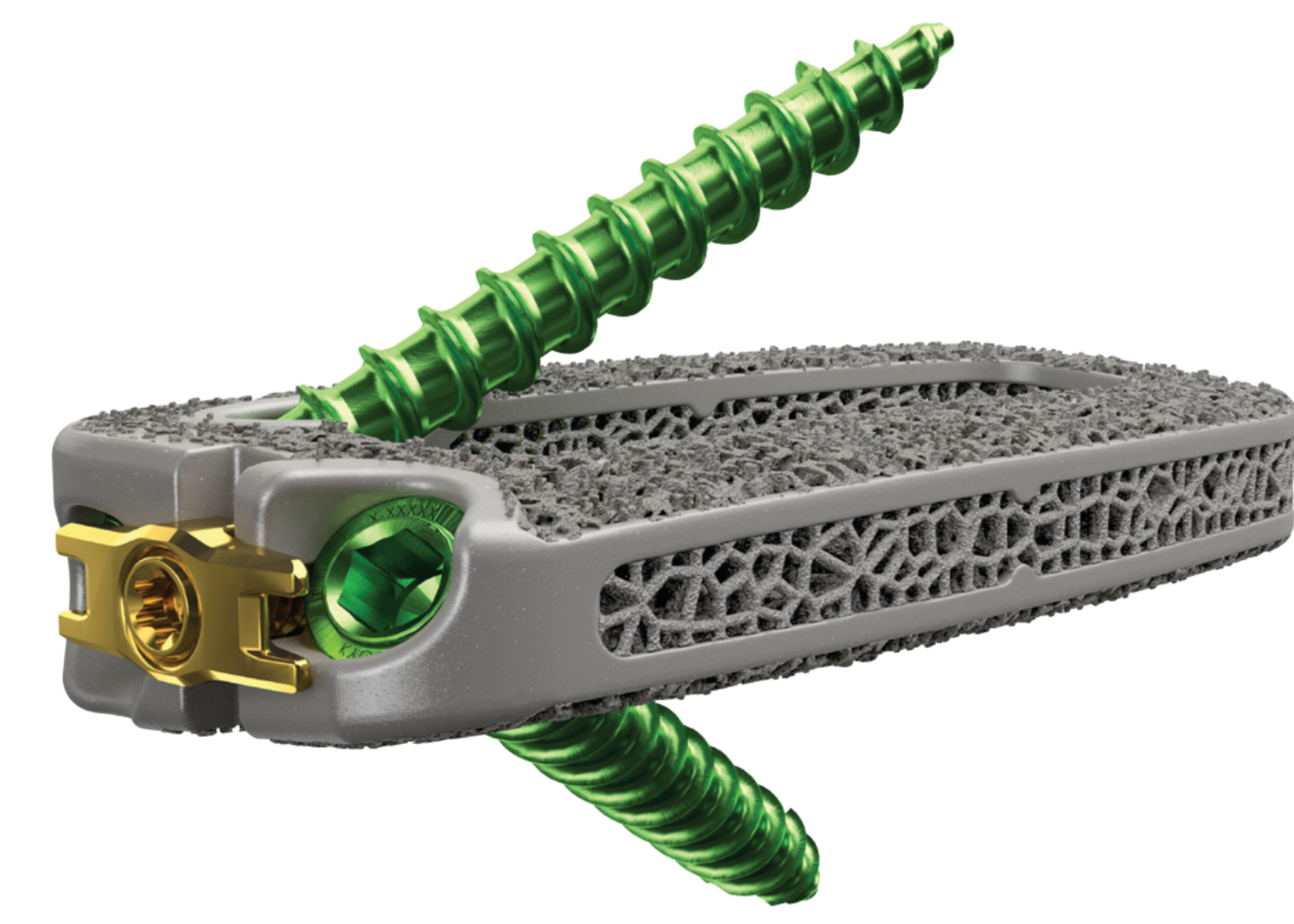 KYOCERA Medical Technologies, Inc. Announces Launch of Tesera® -K XL System, Advancing 3D-printed Lateral Spine Surgery Solutions 119