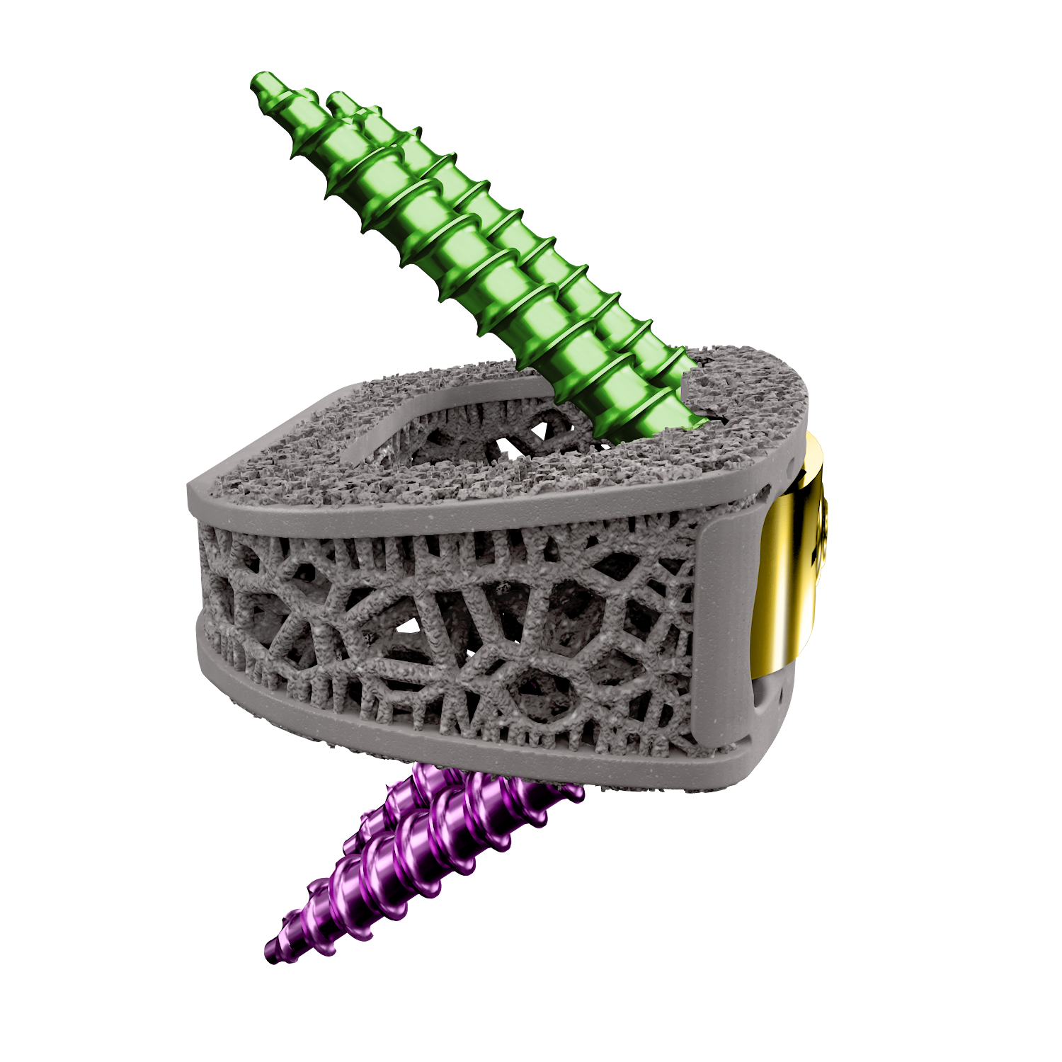 Tesera® -K SA - Anterior Lumbar (ALIF) Interbody Fusion System 122