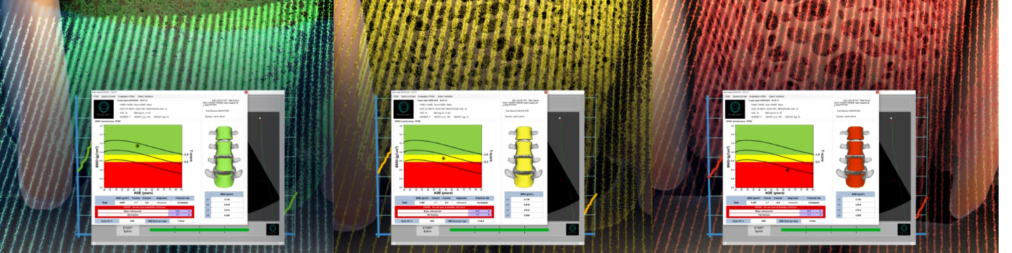 Echolight Medical 70