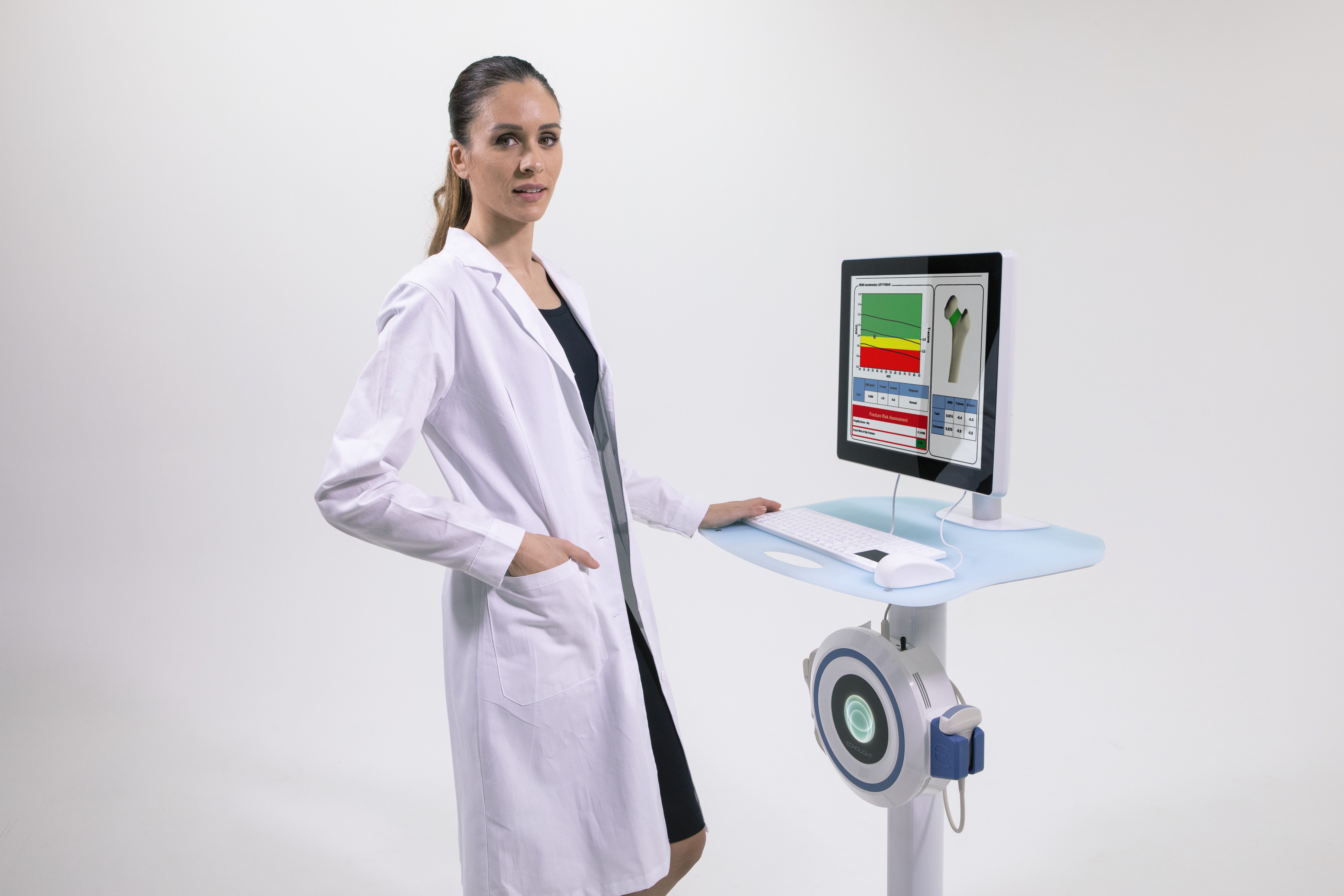 EchoStation bone density scanner 20