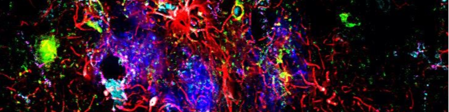 Akoya Biosciences Inc. 387