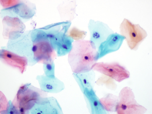 American Society of Cytopathology (ASC) 55