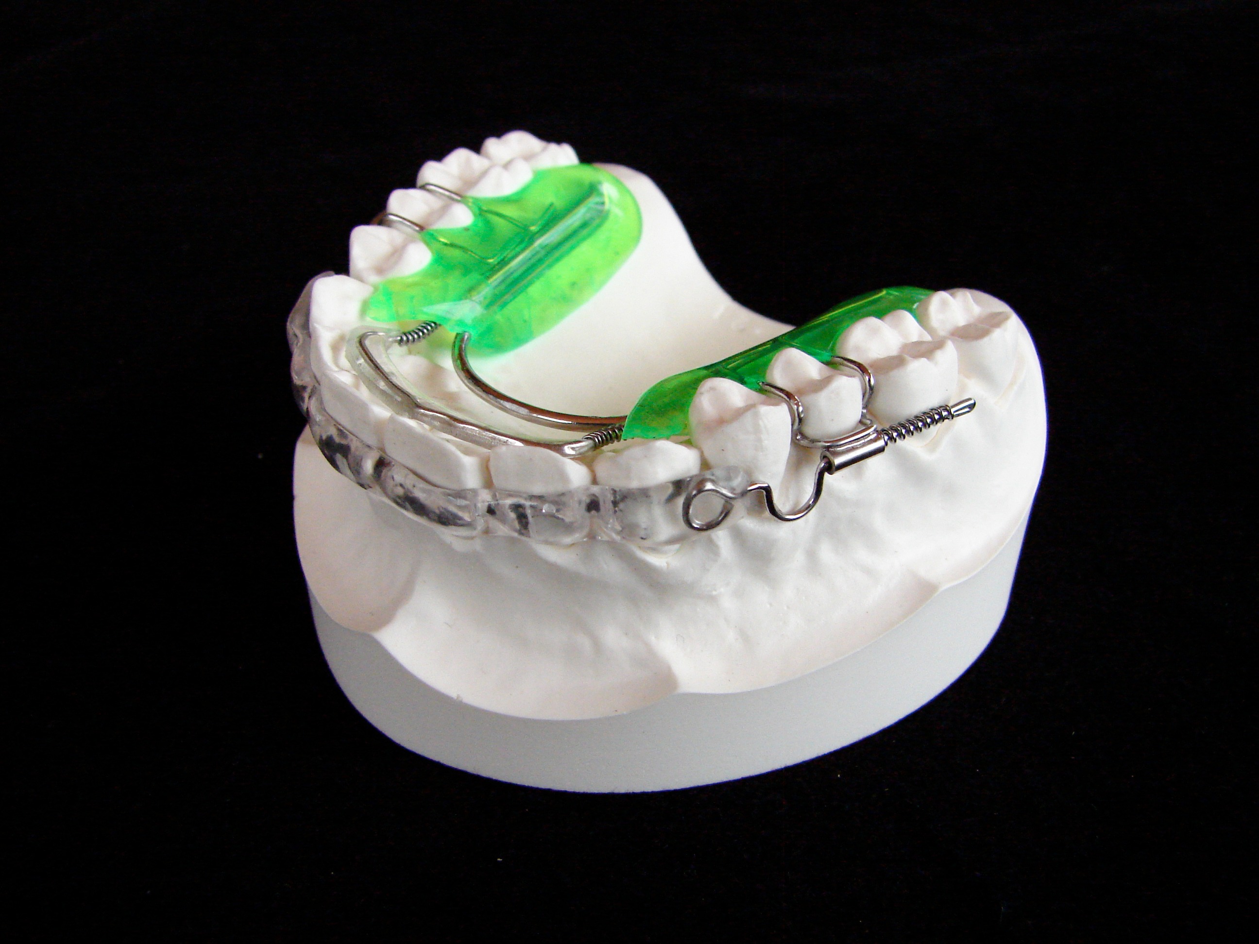 Inman Aligners 22