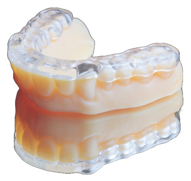 Inman Digital Splints (IDS) 24