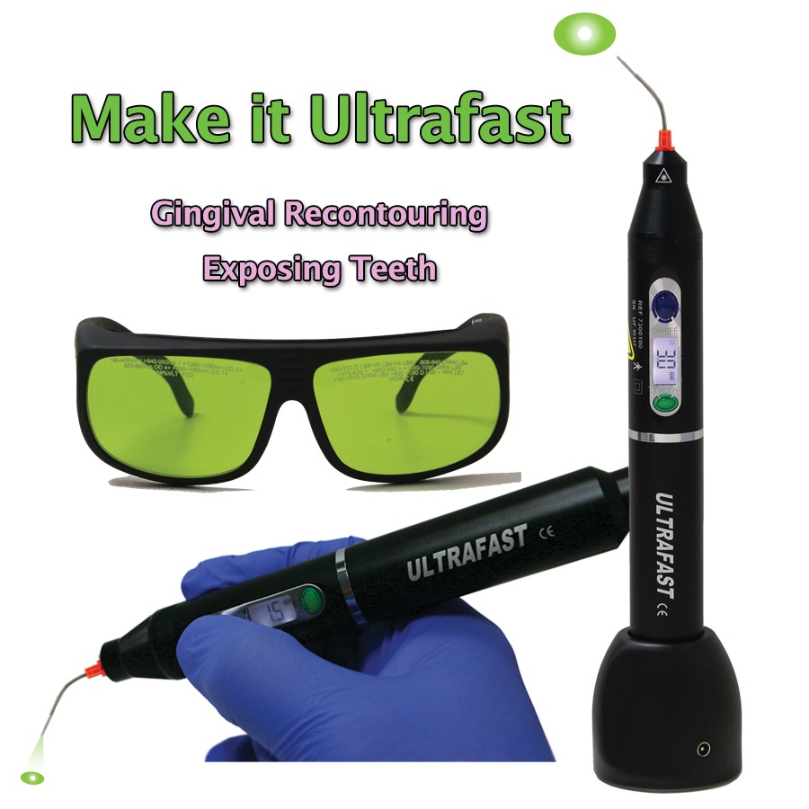 Ultrafast Wireless Diode Laser 61