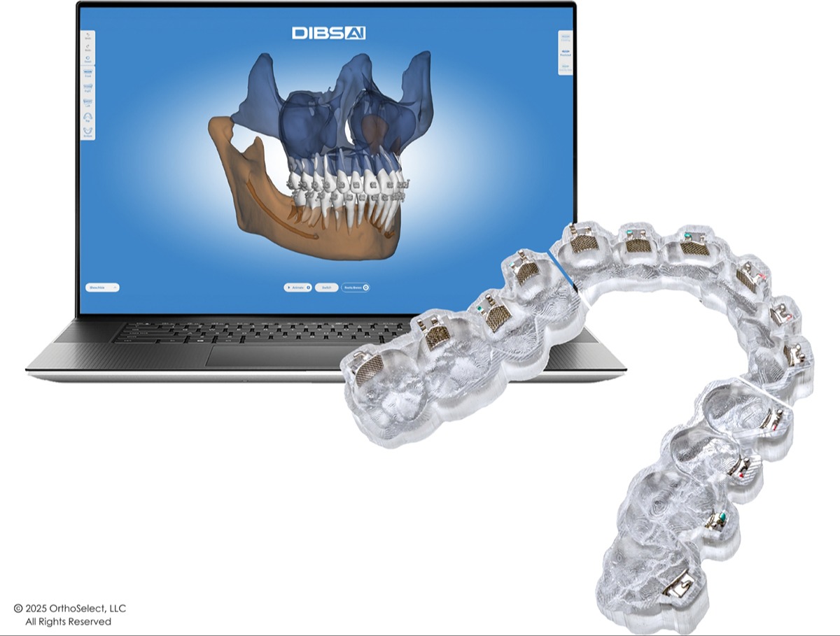 Save $3,495 on DIBS AI 98
