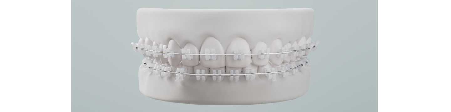 LightForce  Ortho 41