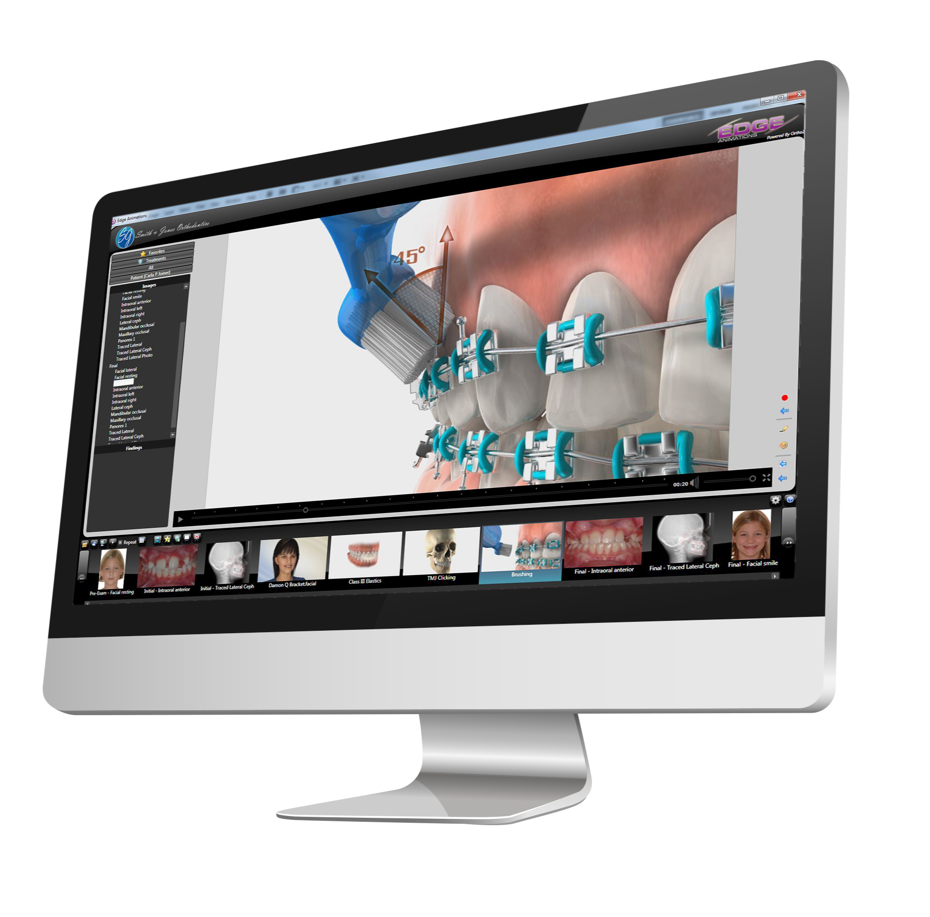Edge Animations 23