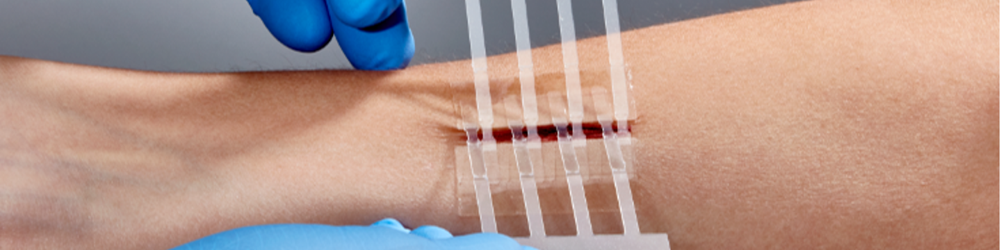 Clozex Medical, Inc. 242