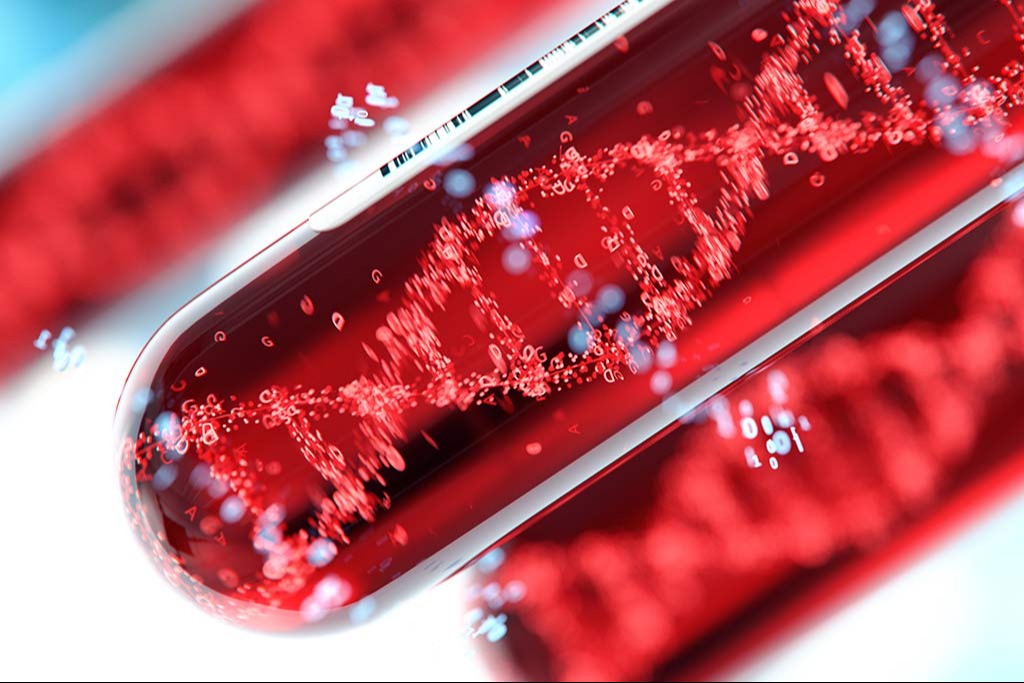 Overcoming Challenges in Liquid Biopsy Experimental Design 887