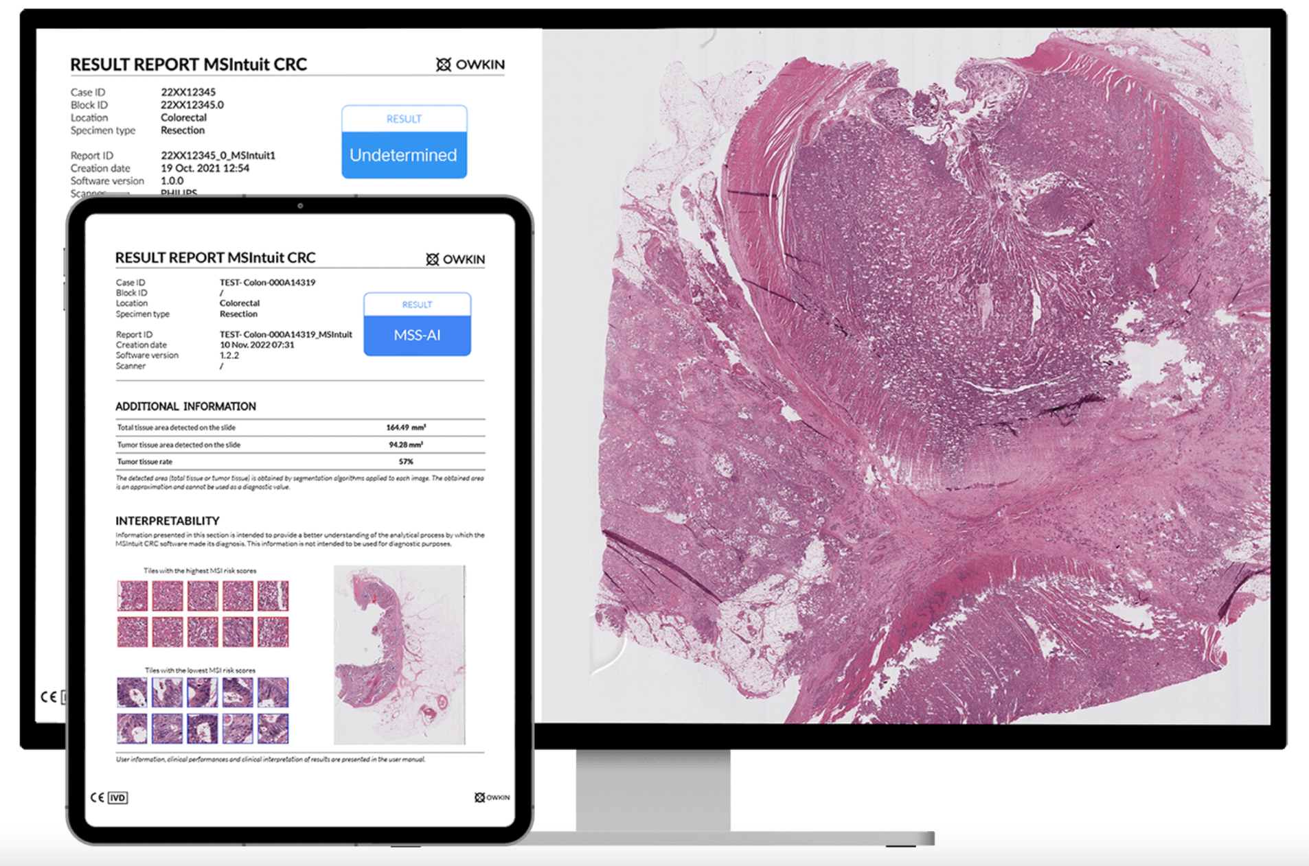 MSIntuit® CRC 159