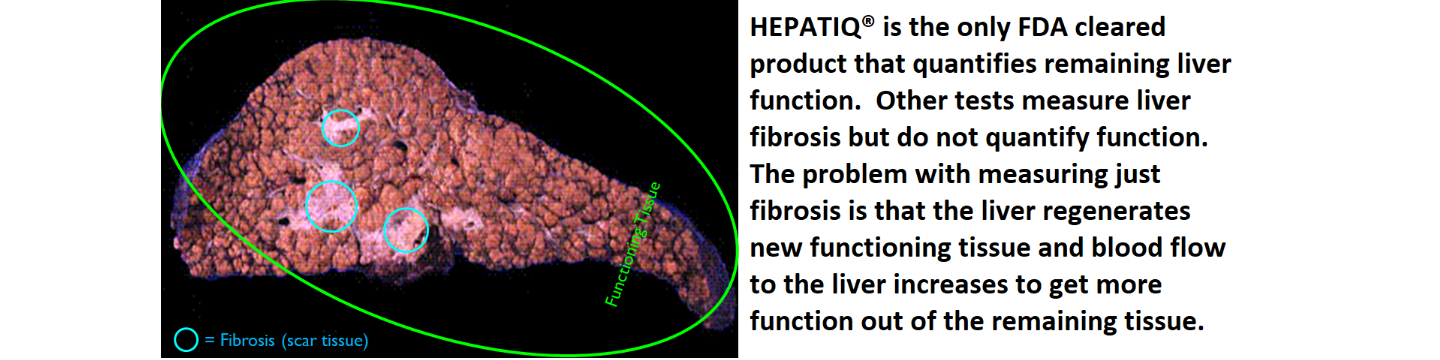 Hepatiq, Inc. 25