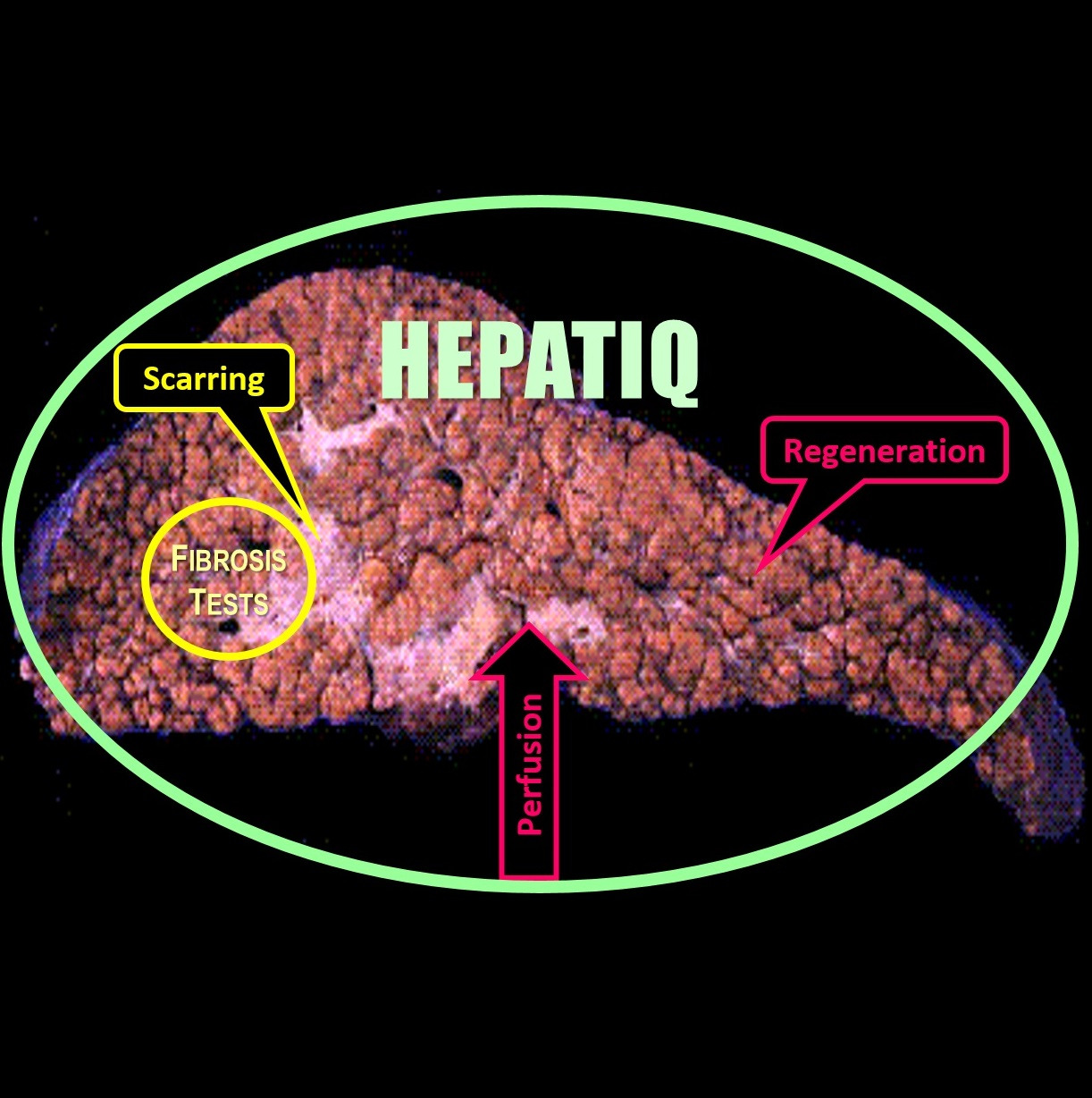 HEPATIQ - The Ultimate Liver Test 131