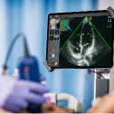 Kosmos by EchoNous Point-of-Care-Ultrasound (POCUS) 260