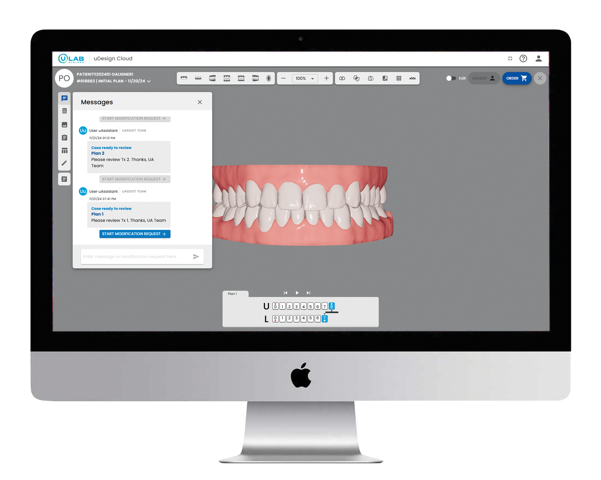 uDesign® Cloud, web-based workflow for aligners 20