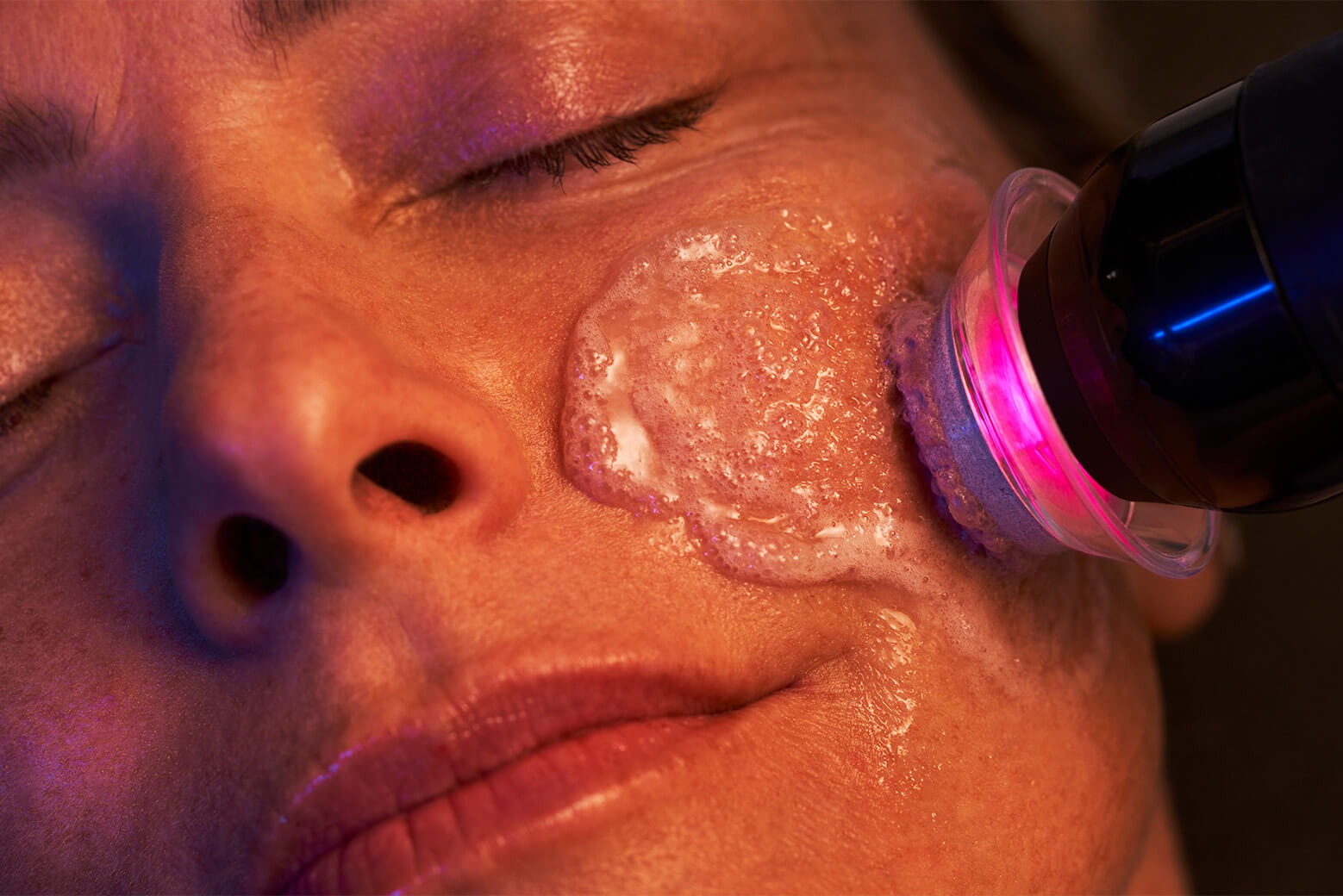 Glo2Facial: The Go-To Treatment for Rebalanced Beauty 88