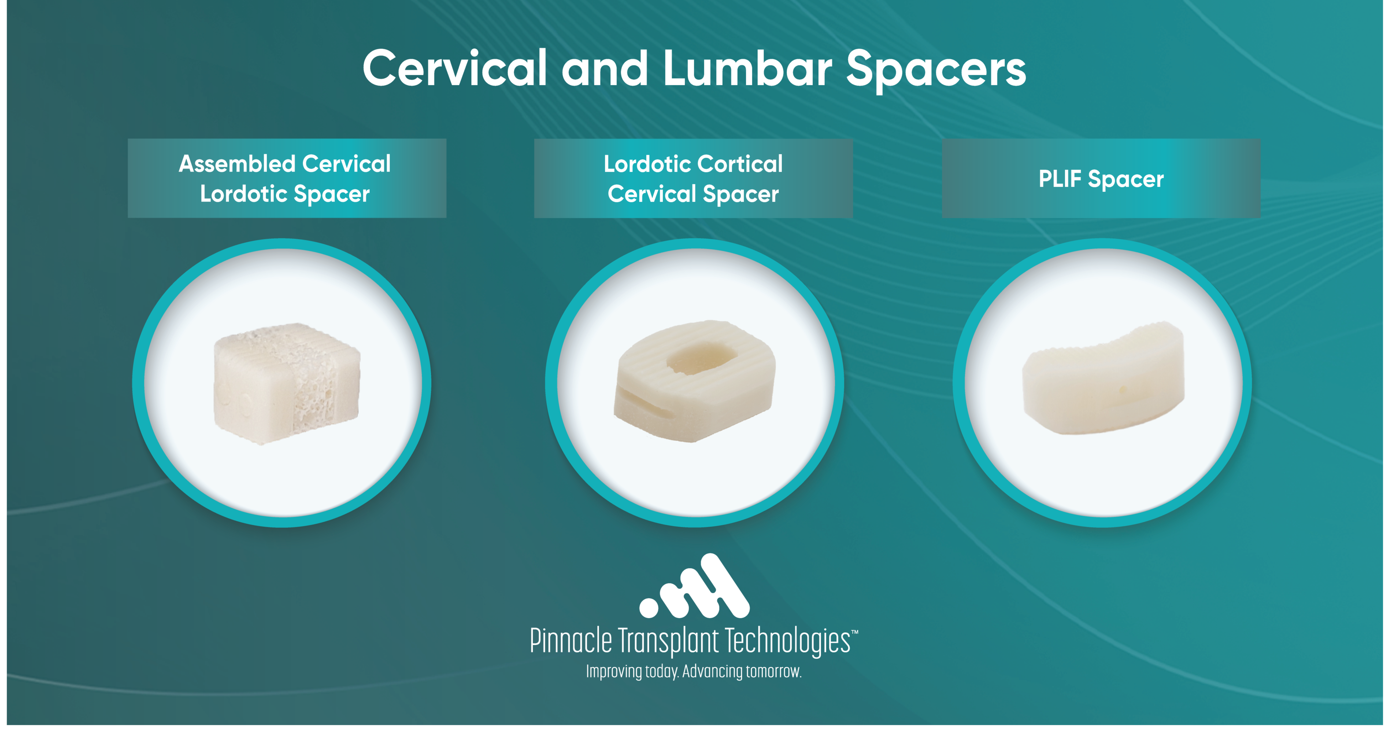 Cervical & Lumbar Spacers 107