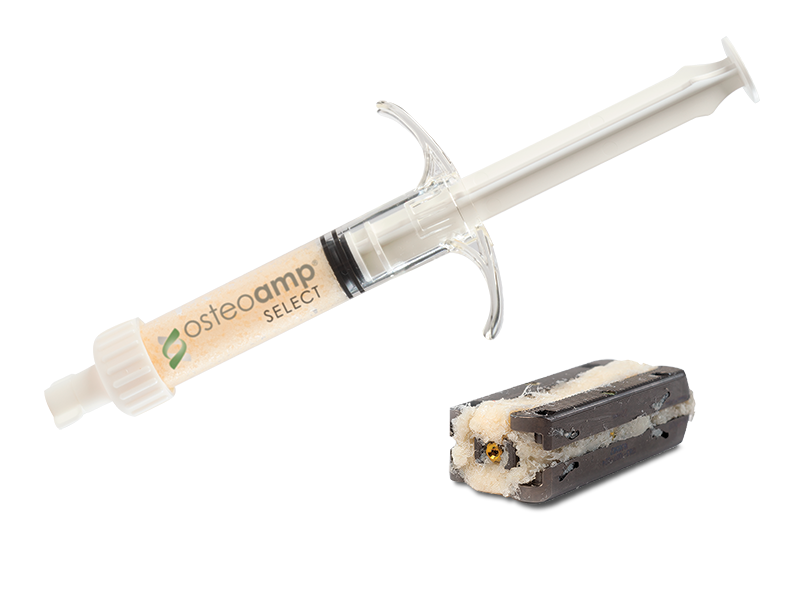 OsteoAmp: A Versatile Allograft Backed by Peer-Reviewed Evidence. 161