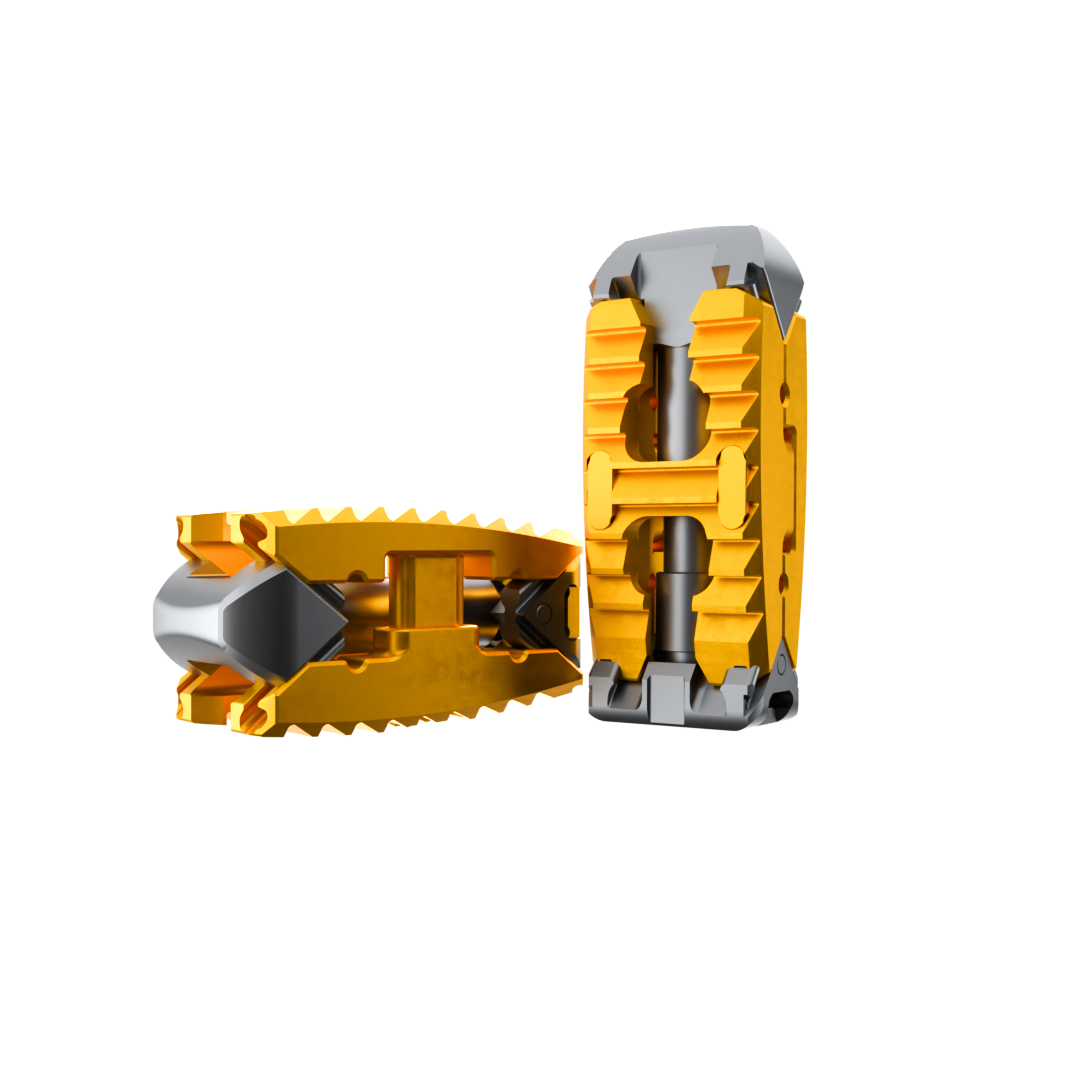 L&K Spine’s Expandable TLIF/PLIF Cage Surpasses 4,000 Levels Implanted in the U.S. — With Zero Reported Failures 143