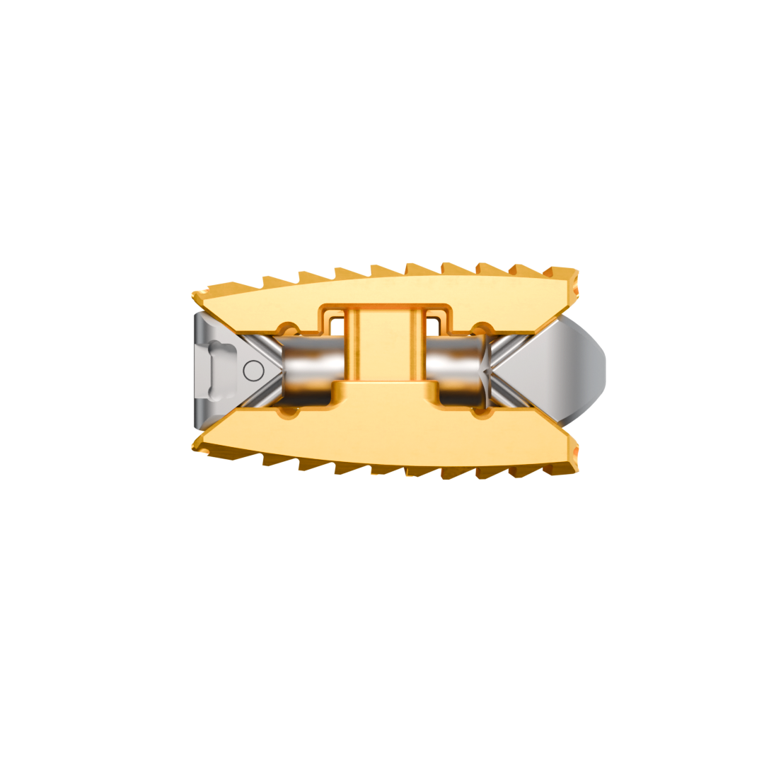 Expandable TLIF cage 144