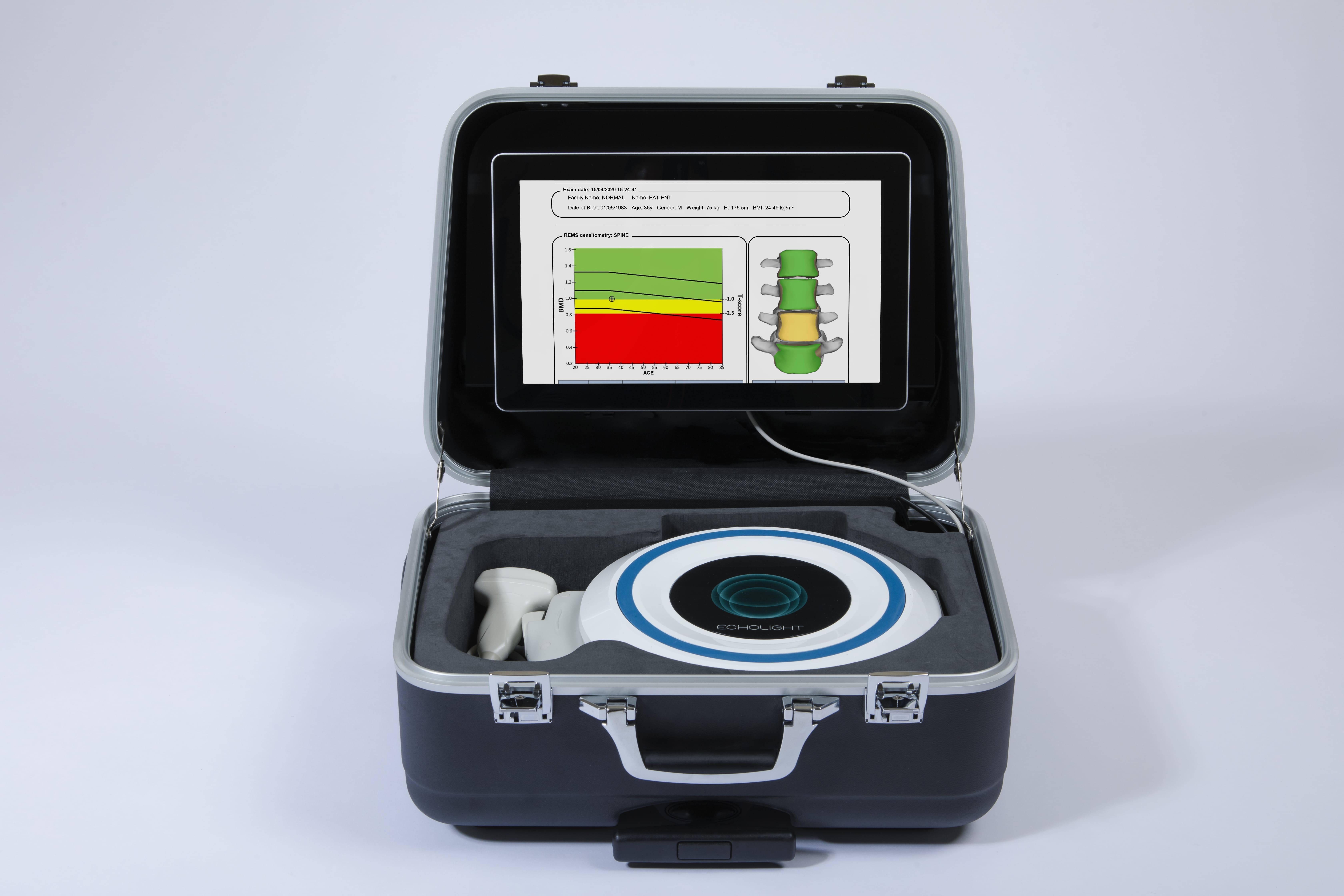 EchosPlus portable bone density scanner 21