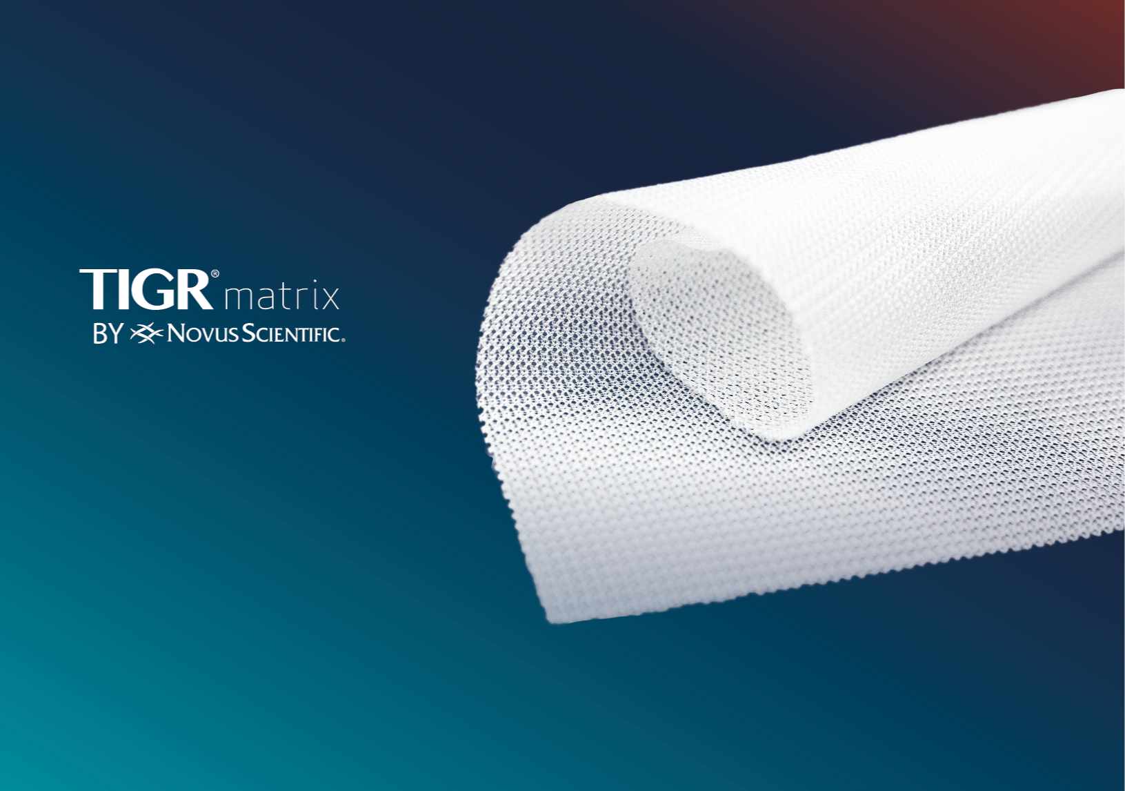 TIGR® Matrix 99
