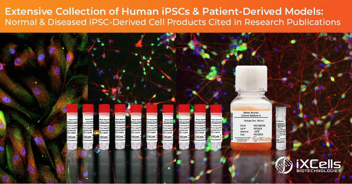 sfn-ixcells-biotechnologies.jpg