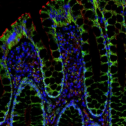 Atlas Antibodies 293