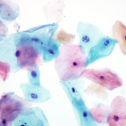 American Society of Cytopathology (ASC) 55